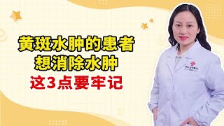 黄斑水肿的患者 想消除水肿 这3点要牢记 [upl. by Cloris]