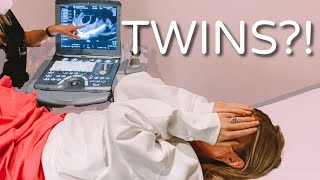 SHOCKING ULTRASOUND TWINS  LAUREN amp ARIE [upl. by Maggee]