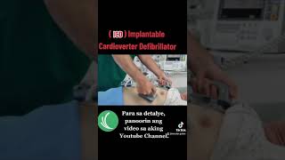 Implantable Cardioverter Defibrillator ICD [upl. by Eissirc624]