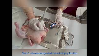 Ultrasound Guided Breast Biopsy  step 1  in vitro [upl. by Allehcim]