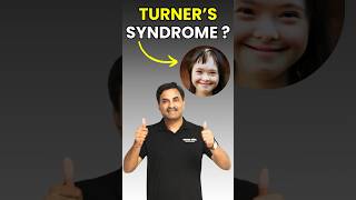 Turner’s Syndrome  The Chromosomal Disorder 😰 biology neet2024 neetbiology turnersyndrome [upl. by December]