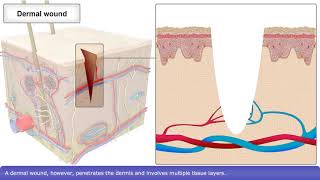 Skin Wound Healing Process [upl. by Ahsote]