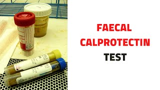 FECAL STOOL CALPROTECTIN TEST Uses Inflammatory Bowel Disease [upl. by Menzies]