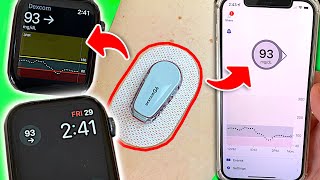 How to View Blood Sugars on Phone and Watch 4 Tips for Dexcom Users [upl. by Mayram389]