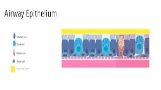 MilanesiExerciseInduced Bronchoconstriction ExerciseInducedAsthma [upl. by Esten]