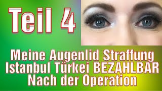 Schlupflider Operation Vorher Nachher Augenlidstraffung Erfahrung Türkei Oberlidstraffung [upl. by Zelikow]