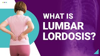 What is Lumbar Lordosis [upl. by Hsirt]