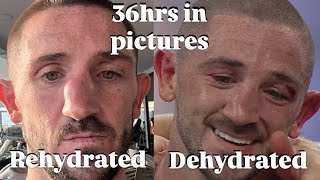 Dehydrated to Rehydrated… 36hrs in pictures [upl. by Friedland]