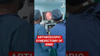 Arthroscopic synovectomy surgery of knee for Synovitis of knee in Jaipur [upl. by Eppesuig]