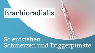 Brachioradialis Schmerzen Triggerpunkte und deren Aktivierung [upl. by Etnaled]