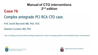 Case 76 Manual of CTO Interventions  Antegrade wire escalation [upl. by Casar442]