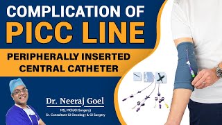 Understanding Complications and Management of Peripherally Inserted Central Catheters PICC line [upl. by Annodam911]