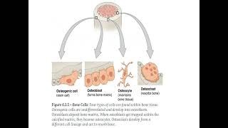 Chapter 09 Musculoskeletal System Disorders revised [upl. by Alien]