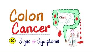 Colon cancer  20 Signs amp Symptoms  Clearly Explained  Cancer Series [upl. by Eaton]