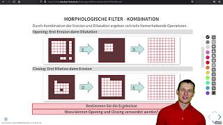 Bildverarbeitung  Nichtlineare Filter  OpeningClosingMedian [upl. by Tilla]