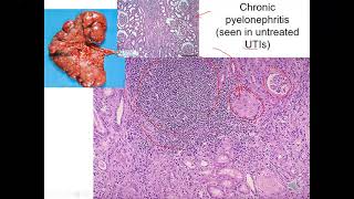 BIO3120065 KIDNEY PATHOLOGY LAB 41321 [upl. by Notwal353]