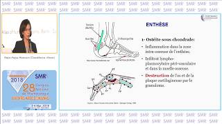 Le Rhumatisme Psoriasique  une prise en charge en pleine mutation [upl. by Tella]