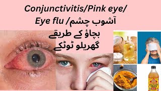 Conjunctivitis Causes symptoms and treatment of conjunctivitis [upl. by Bronwen]