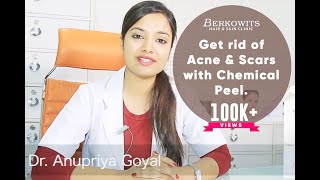 Chemical Peel for Acne Scar and Microneedling Skin Peeling Treatment [upl. by Coop]