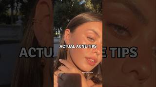 6 Actual Acne Tips viralshorts acnetreatment acnescars [upl. by Westhead356]