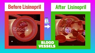 LISINOPRIL Tablets For The Treatment of HBP and Heart Failure [upl. by Claude523]