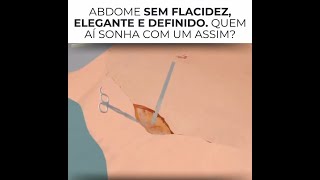 O segredo do abdome sem flacidez elegante e definido está na técnica [upl. by Dloreg825]