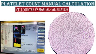 Platelet Count Manual Calculation ।। Cross Check Cellcounter Vs Slide Calculation [upl. by Tarsuss]