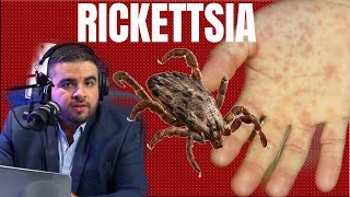 Rickettsiosis o Fiebre Manchada Enfermedad transmitida por Garrapatas [upl. by Dahij]