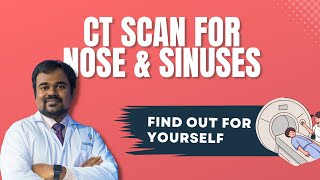 CT scan Nose Sinuses  Sinusitis  Dr G V K Chaitanya Rao [upl. by Polloch977]