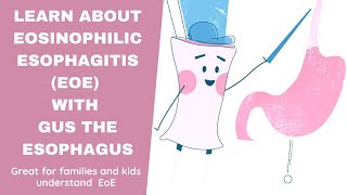 Learn about Eosinophilic Esophagitis EoE with Gus the Esophagus [upl. by Ontina478]