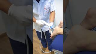 Fascitis Plantar Tratamiento con Ondas de Choque [upl. by Aniroz]