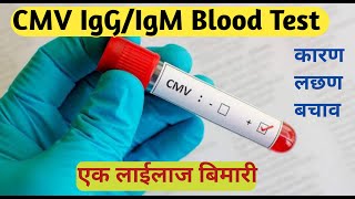 cmv test in hindi  CYTOMEGALOVIRUS TEST  cmv igg igm blood test [upl. by Nueoras396]