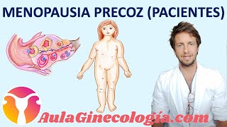 MENOPAUSIA PREMATURA o PRECOZ PACIENTES Necesidad de tratamiento  Ginecología y Obstetricia [upl. by Avevoneg]