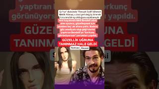 ÇUKUR DİZİSİNİN TİMSAH CELİLİ AHMET MEKİH YILMAZ C₺NSampT DEĞİŞTİREREK YENİ ADI MELİ BANDELİ OLDU [upl. by Jessalyn]