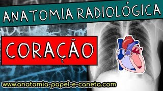 Anatomia radiológica RX do TÓRAX  CORAÇÃO [upl. by Aneeled]