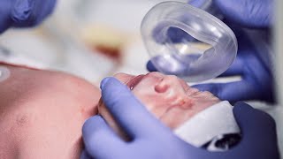 Module 2 Neonatal Resuscitation [upl. by Ewart628]