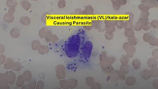 Leishmania donovani bodies under the microscope [upl. by Luapnoj]