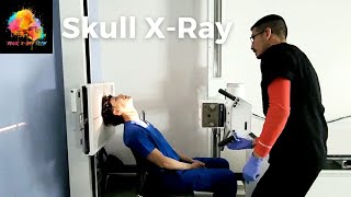 XRay Positioning  Skull SMV view ☢️ YourXRayTech [upl. by Mcnalley952]