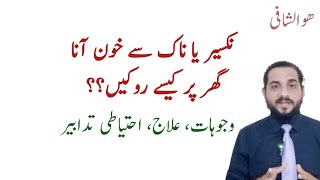 Nakseer ka ilaj in urdu  نکسیر کیوں آتی ہے  Epistaxis ent lecture  Dr Talha [upl. by Eyot]