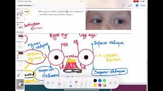 trochlear and abducens nerve palsy ophthalmology 30  First Aid USMLE Step 1 in UrduHindi [upl. by Eelrebmyk511]