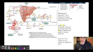 USMLE Question of the Day 69 Abetalipoproteinemia [upl. by Tongue280]