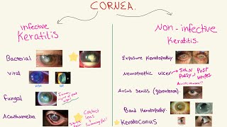 Disorders of the CORNEA  شرح الرمد [upl. by Claman]