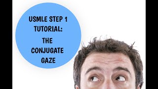 USMLE Step 1 Tutorial  Conjugate Gaze Explained [upl. by Daniels103]