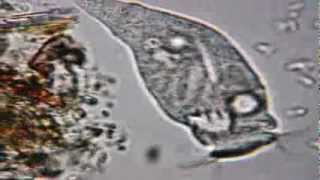 Rotifer at x600 under Celestron PentaView Digital [upl. by Latoniah]