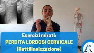 PERDITA della LORDOSI CERVICALE rettilineizzazione protocollo di ESERCIZI [upl. by Igenia]