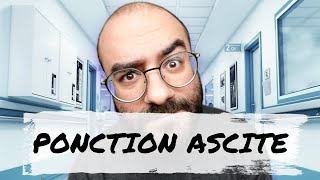 Tutoriel n°2  La ponction dascite [upl. by Etak828]