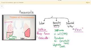 Types of Pneumonia  Lobar  Bronchopneumonia  Interstitial  Diffuse [upl. by Jaime]