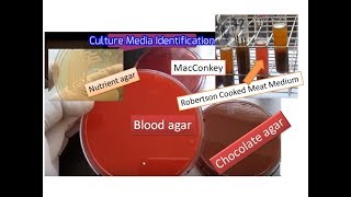 Culture media the simplest way of identification  Blood MacConkey  Chocolate RCM Nurient agar [upl. by Rehotsirhc]