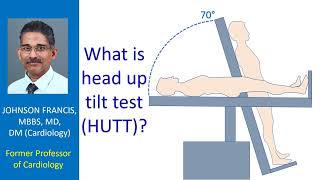 What is head up tilt test HUTT Cardiology Basics [upl. by Eerised676]