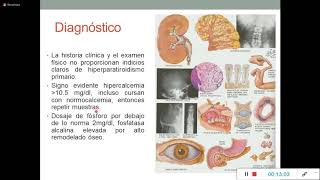 Fisiopatología y Semiología de Hipo e Hiperparatiroidismo [upl. by Asselam]